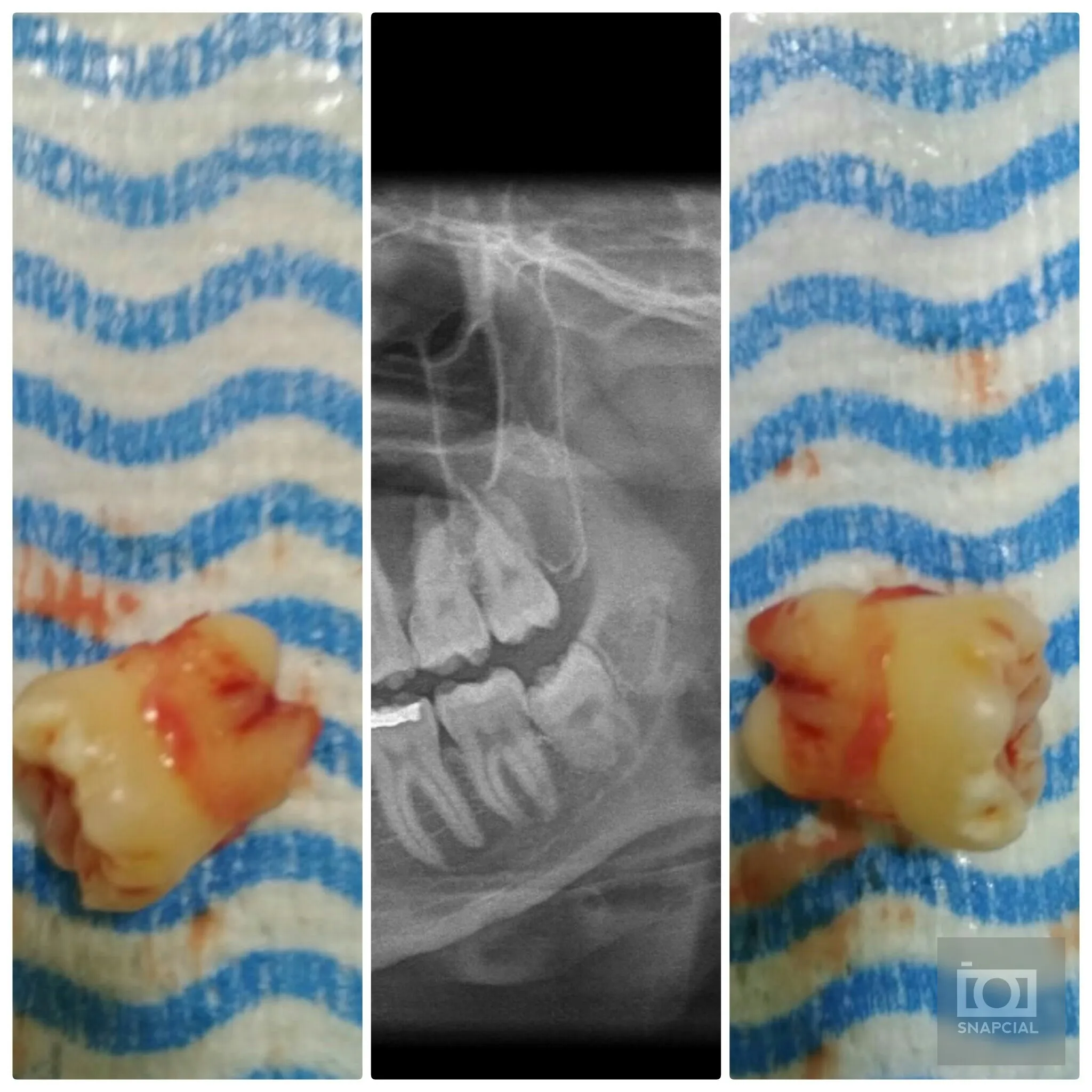 Oral & Maxillofacial Surgery