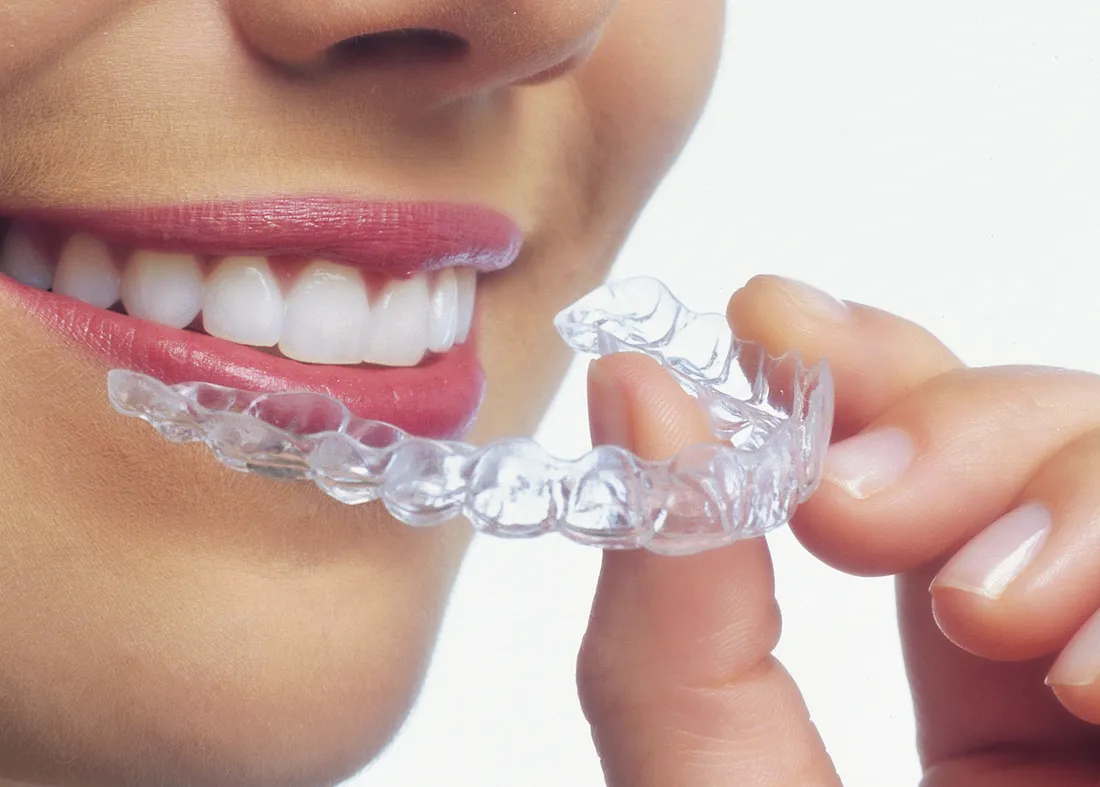 Invisalign treatment